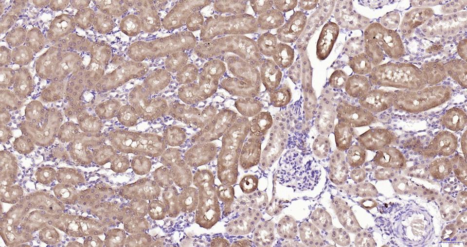 GPX4 Recombinant Rabbit mAb(bs