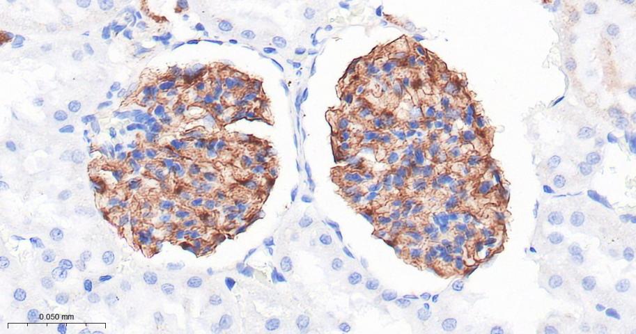 NPHS2 Recombinant Rabbit mAb(b