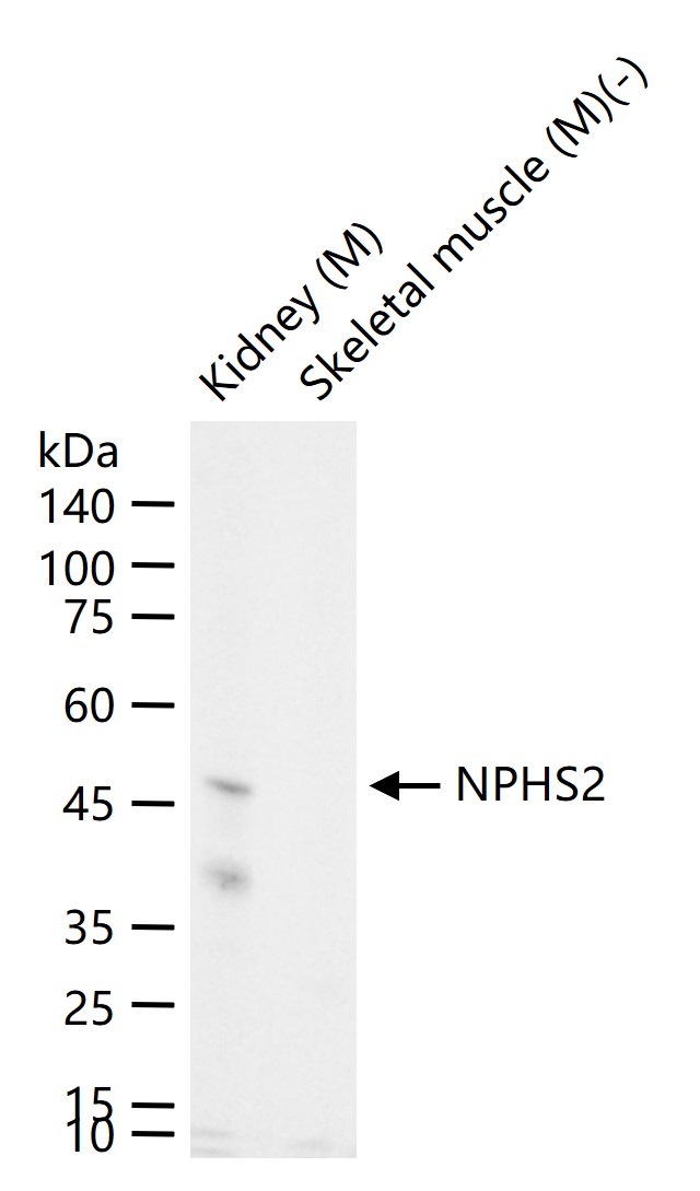 NPHS2 Recombinant Rabbit mAb(b