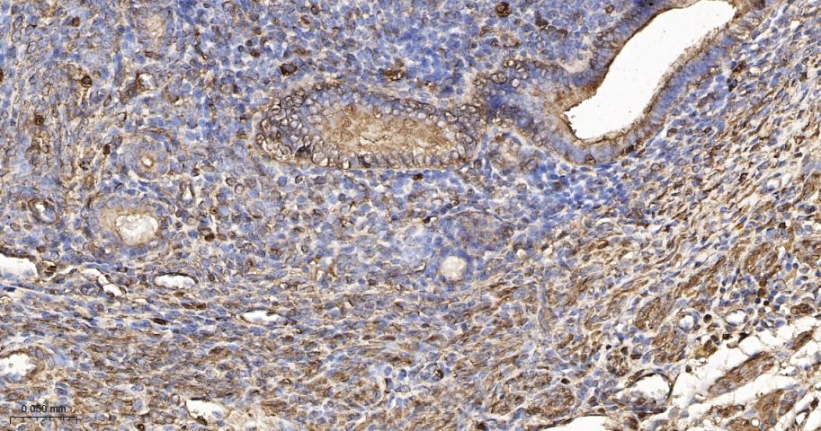 beta Actin Recombinant Rabbit 