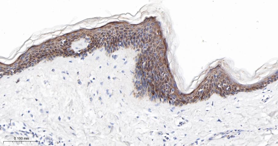 SERCA2 Recombinant Rabbit mAb(