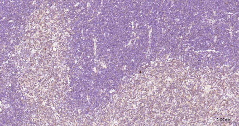 NFKB p65 Recombinant Rabbit mA