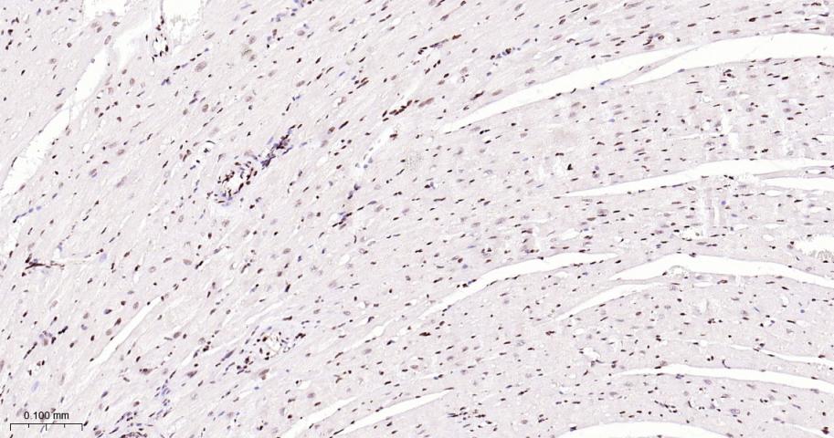 CTBP2 Recombinant Rabbit mAb(b
