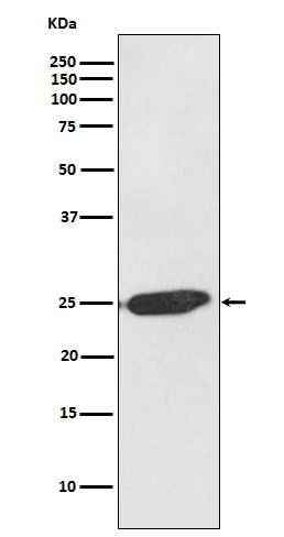 SNAP25 Recombinant Rabbit mAb(