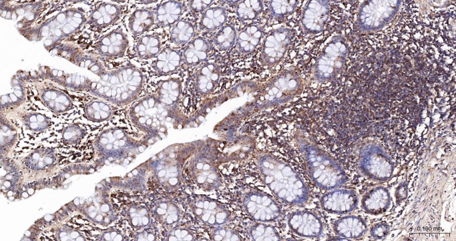 LAMP1 Recombinant  mAb(bsm-413