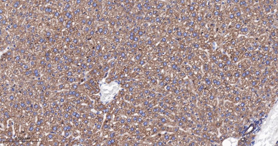 SERCA2 Recombinant Rabbit mAb(