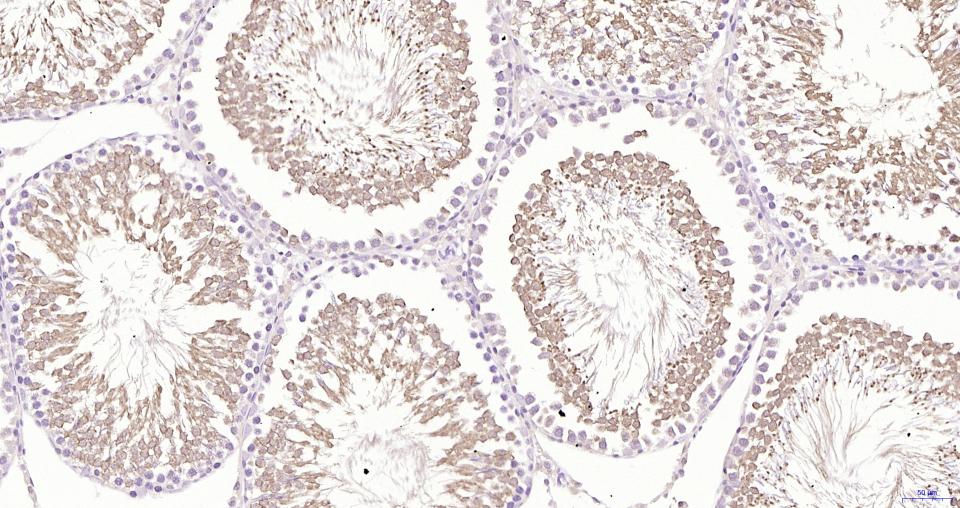 GPX4 Recombinant Rabbit mAb(bs