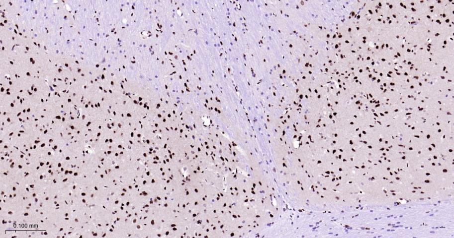 CTBP2 Recombinant Rabbit mAb(b