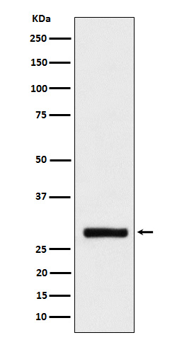 BRMS1 Recombinant Rabbit mAb(b