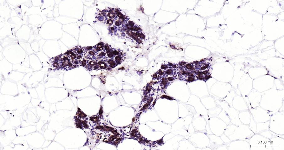 NFKB p65 Recombinant Rabbit mA