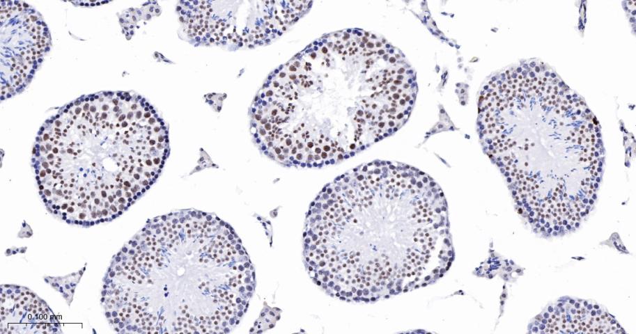 phospho-Histone H3 (S10) Recom