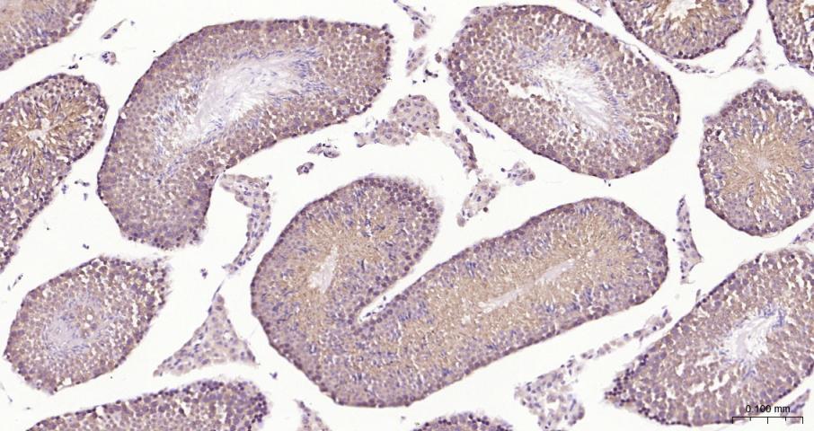 eIF4E Recombinant Rabbit mAb(b