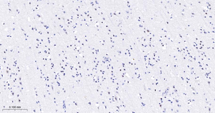 phospho-Histone H3 (S10) Recom