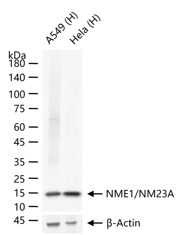 NME1/NM23A Recombinant Rabbit 