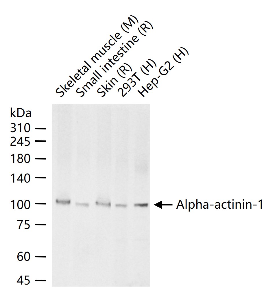 Alpha-actinin-1 Rabbit pAb(bs-