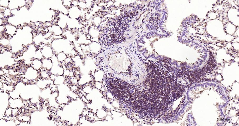 NFKB p65 Recombinant Rabbit mA