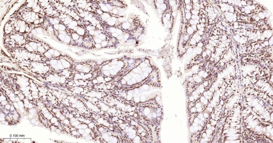 Histone H2A Recombinant Rabbit