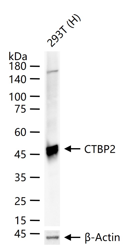 CTBP2 Recombinant Rabbit mAb(b