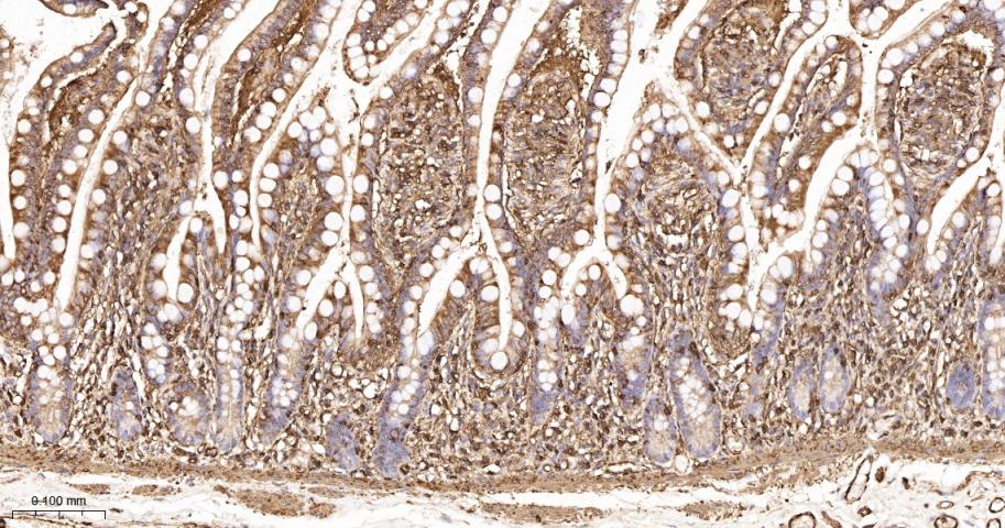 beta Actin Recombinant Rabbit 