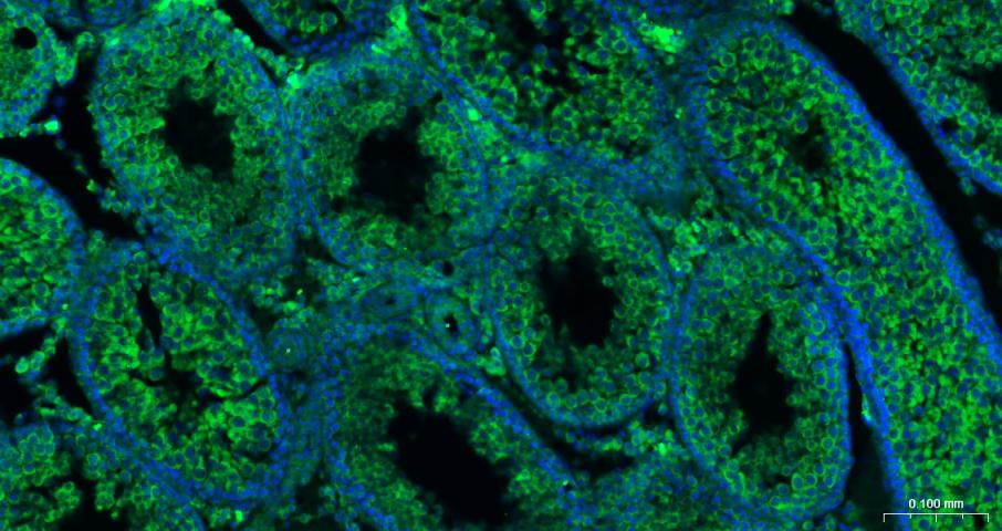 eIF4E Recombinant Rabbit mAb(b
