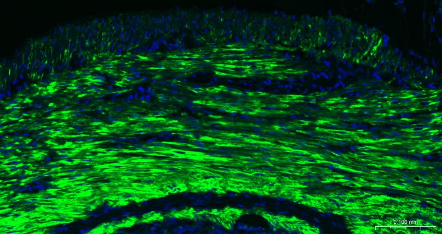 alpha smooth muscle Actin Mous