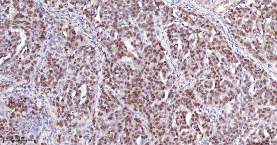 Cleaved PARP1 p25 Recombinant 