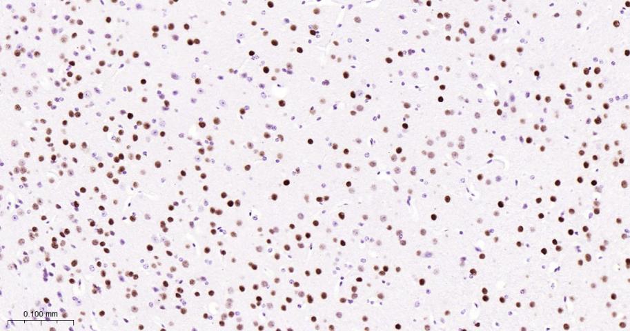 SATB2 Recombinant Rabbit mAb(b