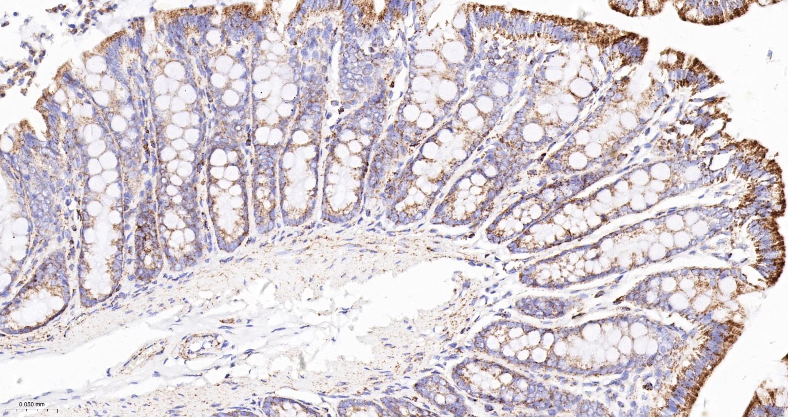 MDH2 Recombinant Rabbit mAb(bs