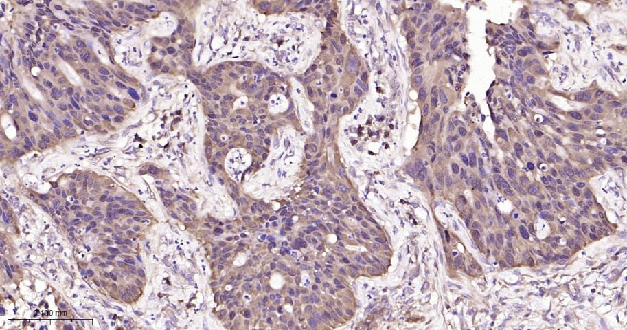 NME1/NM23A Recombinant Rabbit 