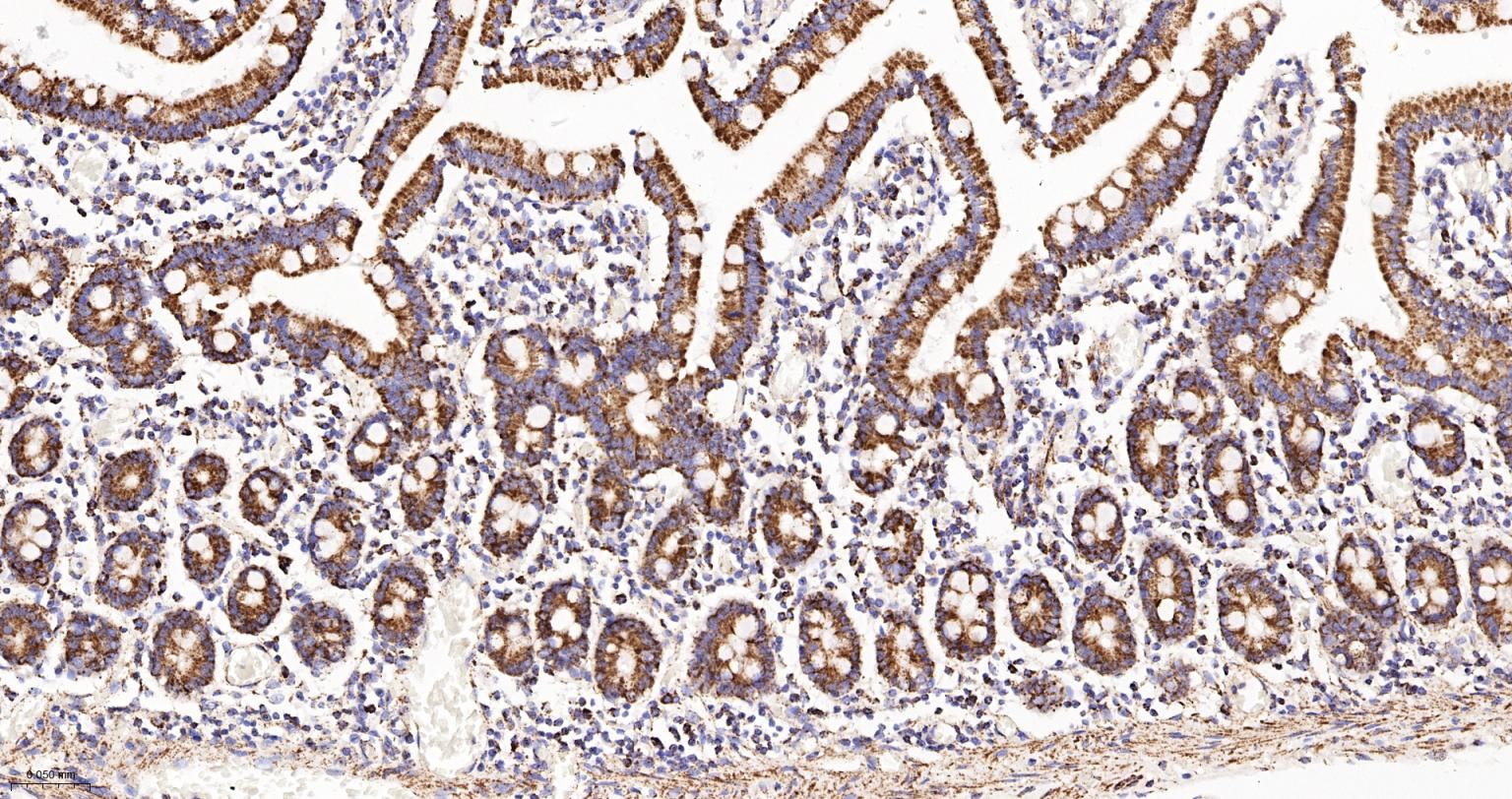 MDH2 Recombinant Rabbit mAb(bs