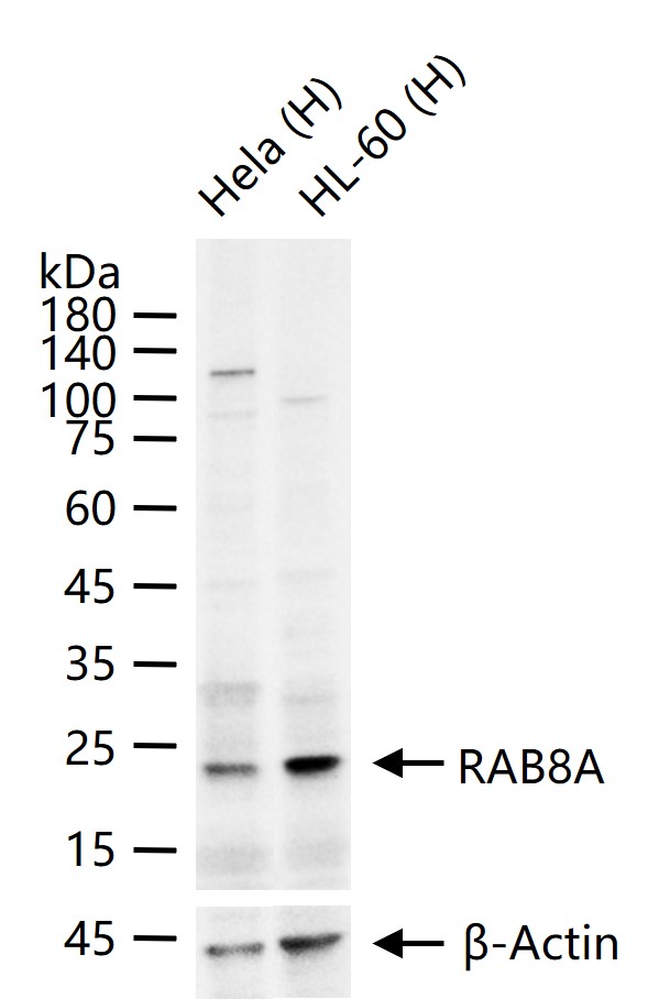 RAB8A Recombinant Rabbit mAb(b
