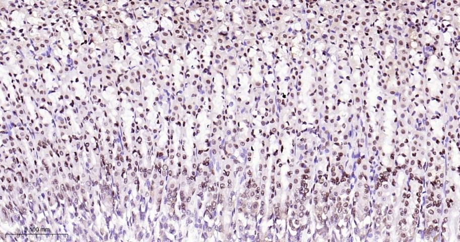 CTBP2 Recombinant Rabbit mAb(b