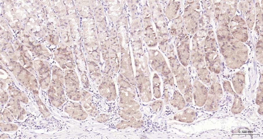 eIF4E Recombinant Rabbit mAb(b