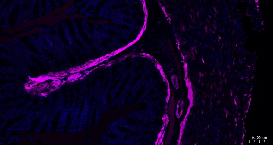 alpha smooth muscle Actin Mous