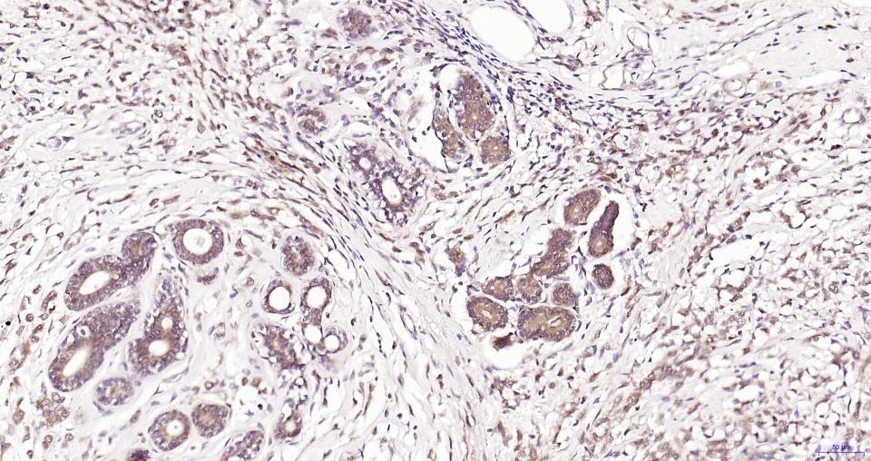 GPX4 Recombinant Rabbit mAb(bs