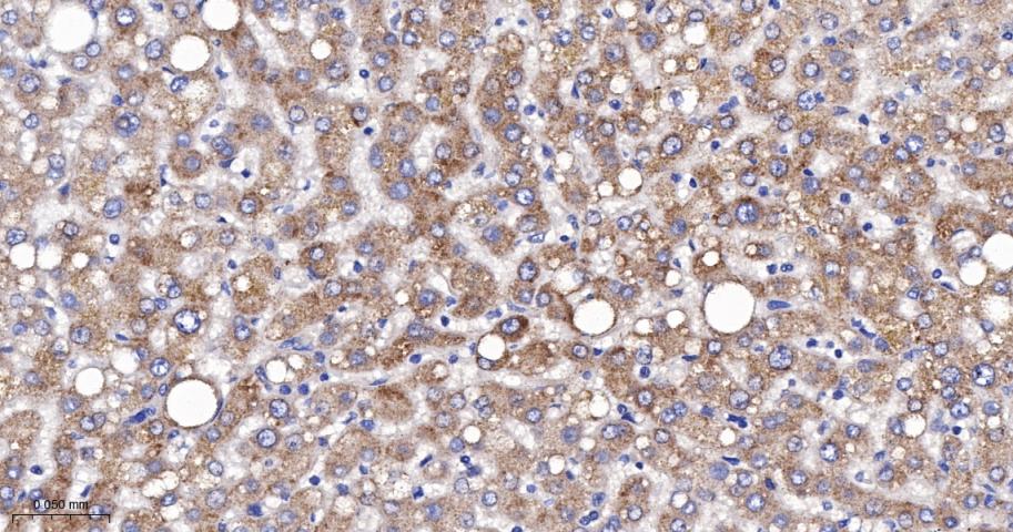 SERCA2 Recombinant Rabbit mAb(