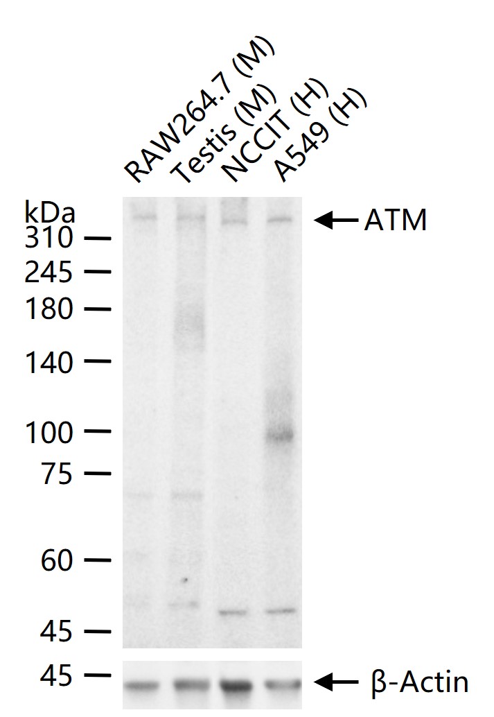 ATM Recombinant Rabbit mAb(bsm