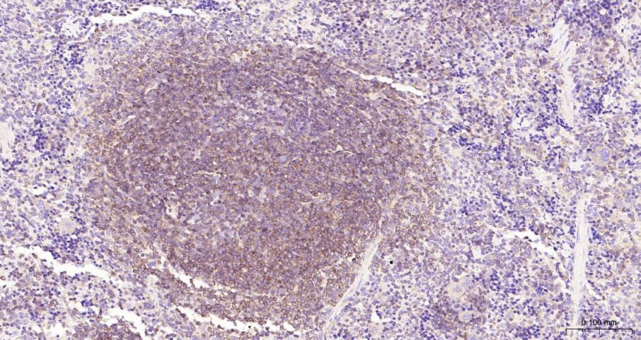 NFKB p65 Recombinant Rabbit mA