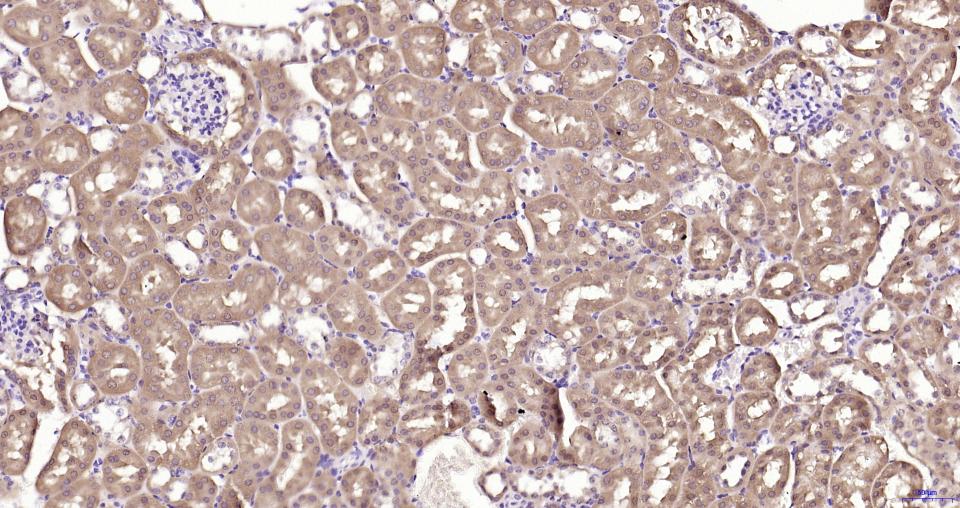 GPX4 Recombinant Rabbit mAb(bs