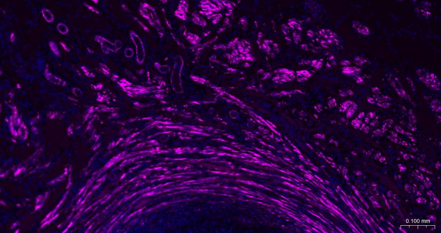 alpha smooth muscle Actin Mous