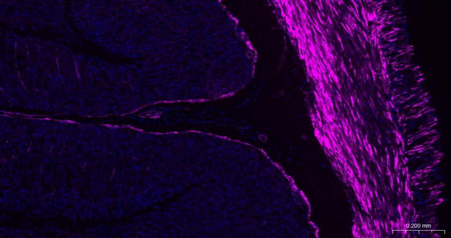 alpha smooth muscle Actin Mous