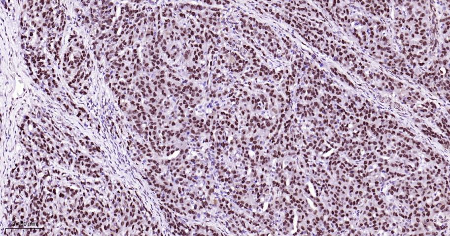 CTBP2 Recombinant Rabbit mAb(b