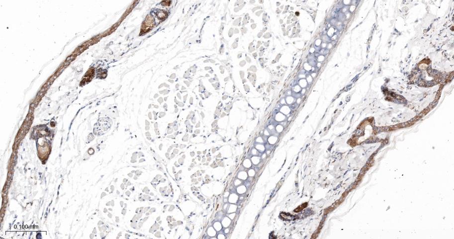 SERCA2 Recombinant Rabbit mAb(