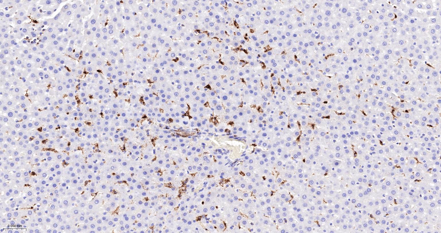CD16 Recombinant Rabbit mAb(bs