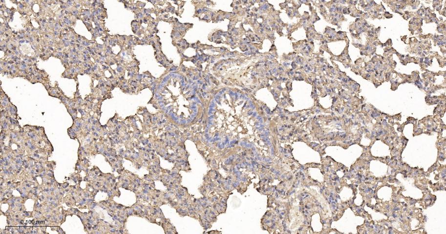 beta Actin Recombinant Rabbit 