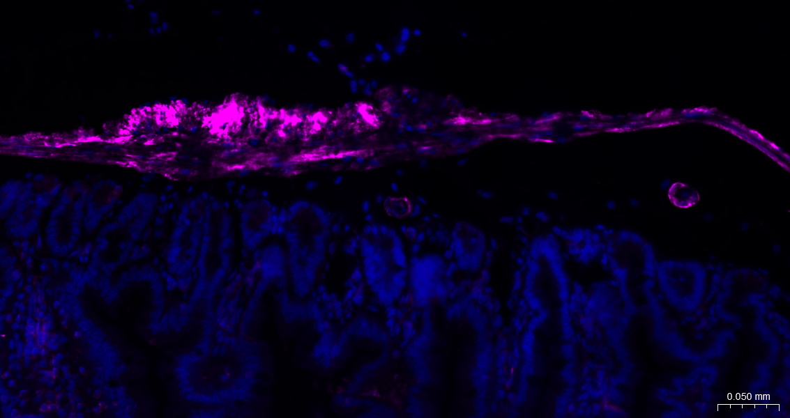 alpha smooth muscle Actin Mous