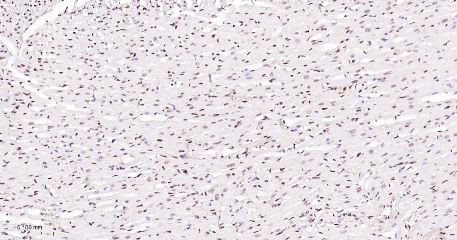 CTBP2 Recombinant Rabbit mAb(b