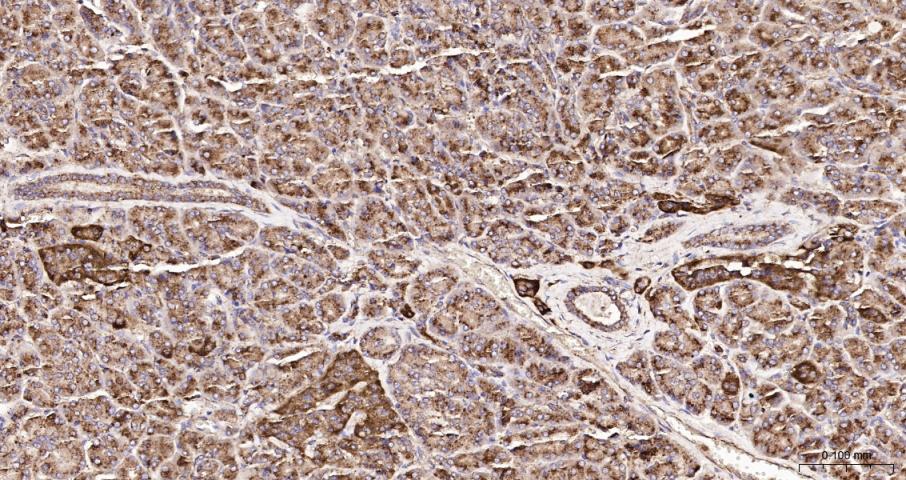 LAMP1 Recombinant  mAb(bsm-413