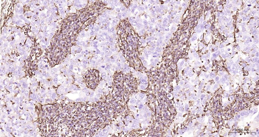 Vimentin Recombinant Rabbit mA