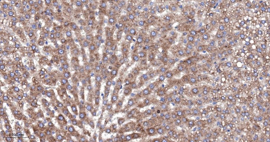 SERCA2 Recombinant Rabbit mAb(